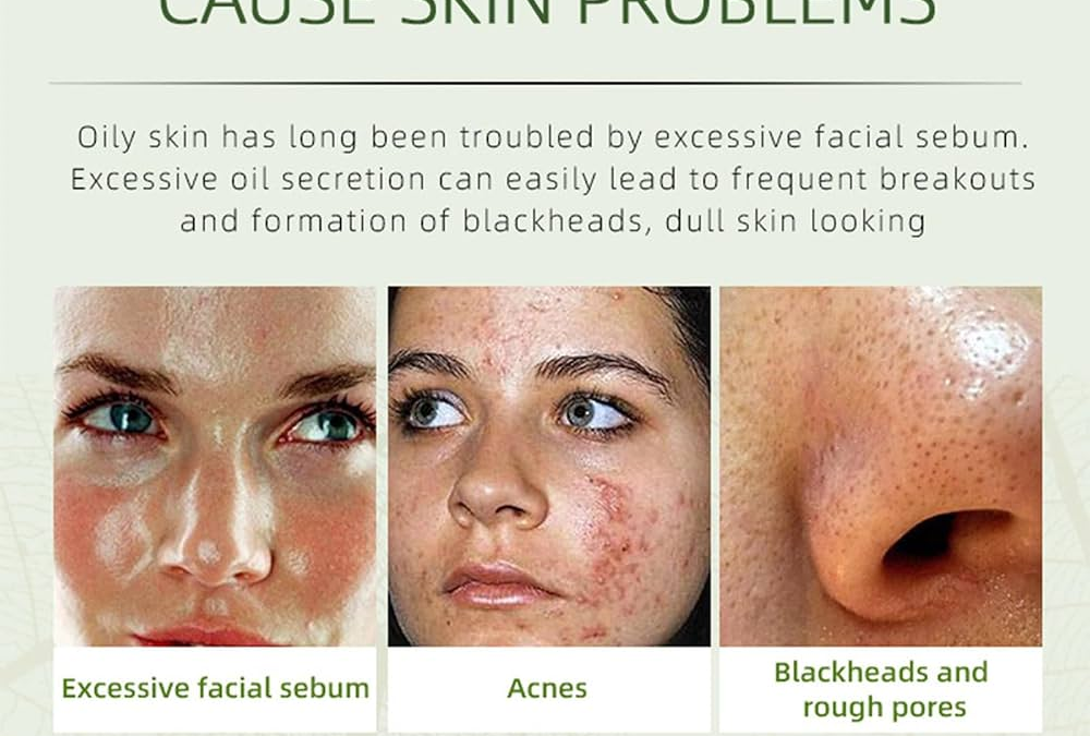 Spot Treatment to Quickly Reduce Blemishes