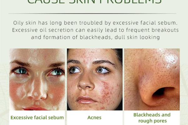 Spot Treatment to Quickly Reduce Blemishes